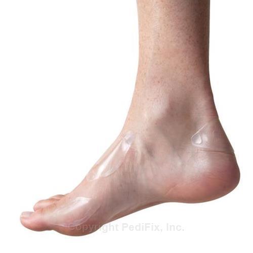sorespot blister and skin protection bandages 2